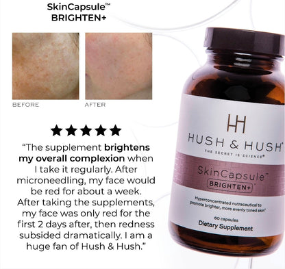 Hush & Hush Acne Supplements for Clear Skin – Clinically Proven Formula to Reduce Breakouts & Blemishes – Supports Hormonal Balance with Vitamin A, Zinc & Antioxidants – Vegan, Non-GMO – 60 Capsules